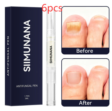 Hand And Foot Nail Thickening Bright Nail Gray Nail Antibacterial Care Solution